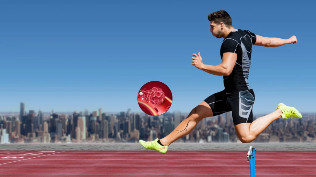 Understanding and Managing Varicose Veins