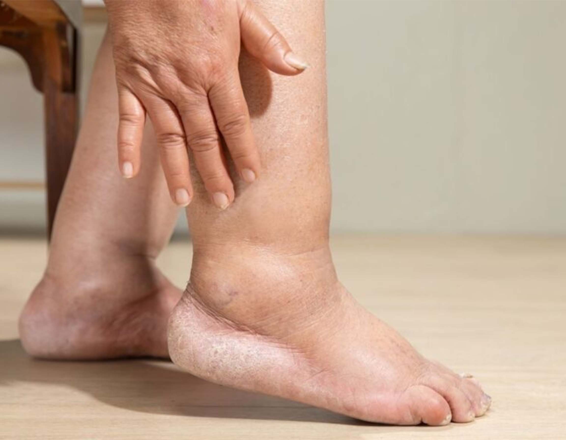 Doppler Ultrasound Diagnosis