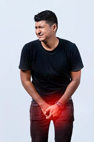 Illustration of Varicose Veins